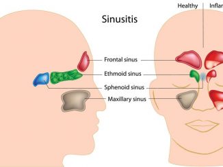 How Long Are Sinus Infections Contagious
