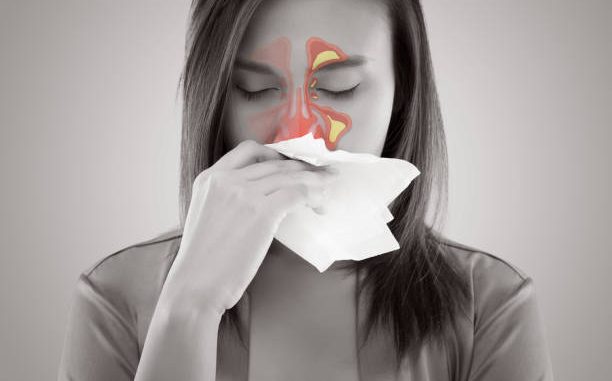 Do Sinus Infections Go Away Do Sinus Infections Go Away