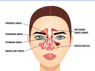 how to prevent sinus infections