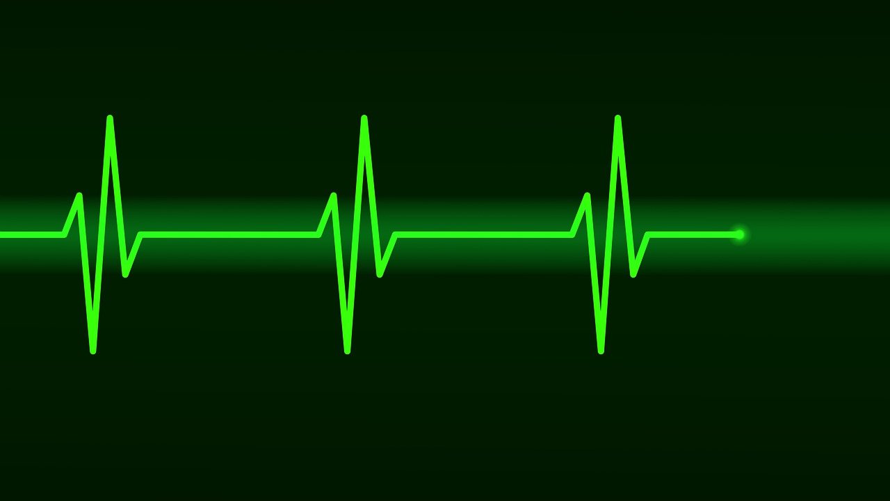 How to Recognize Sinus Rhythm