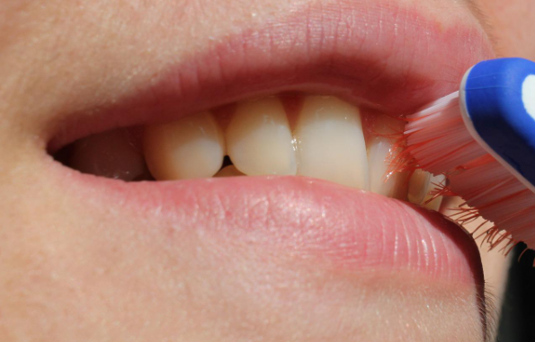 white bumps on gums